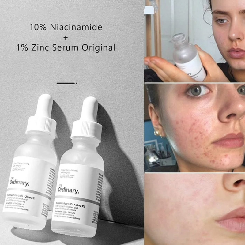 The Ordinary Niacinamide 10% + - Luxury Skincare Brands avaliação e preço